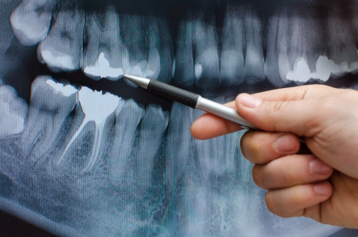 Nederland Smile Docs photo 1