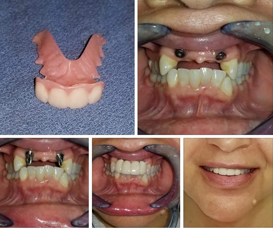 Mid-south Dental Implant & Oral Surgery Center: Keith H. Taylor DDS photo 6