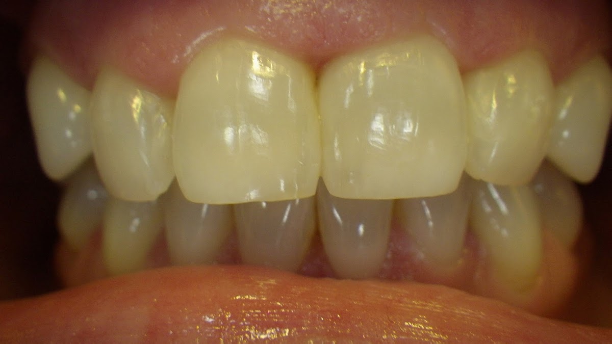 Family Dental Missoula photo 2