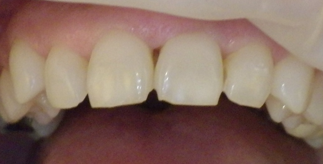 Family Dental Missoula photo 6