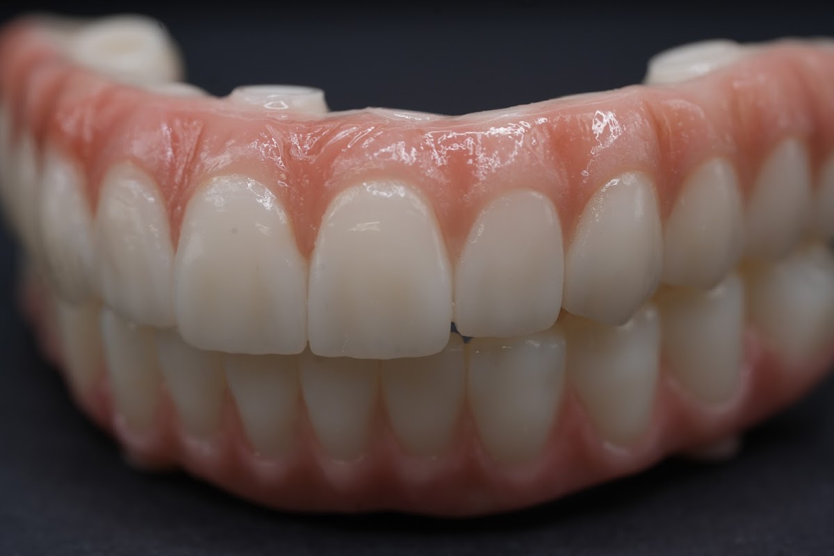 Aria Dental Implant Center photo 4