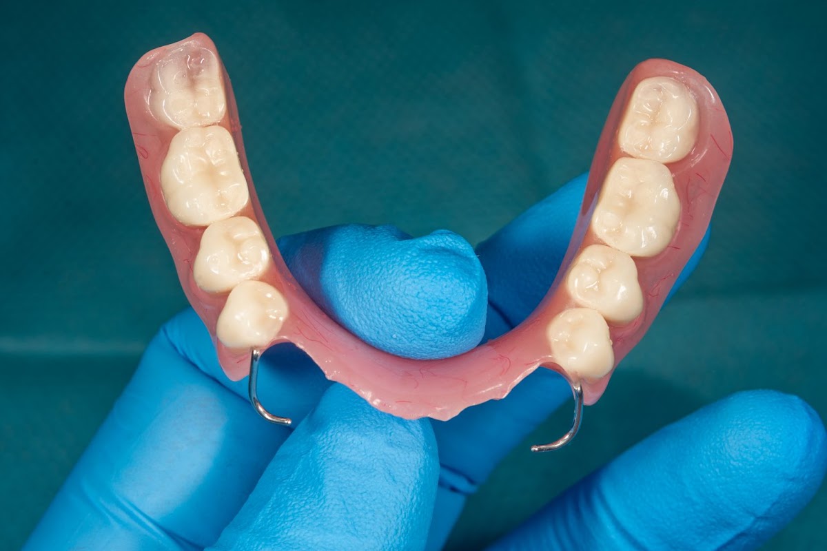 All Smiles Family Dentistry - Dentures, Extractions, Dental Implants, Quick Dentures photo 4
