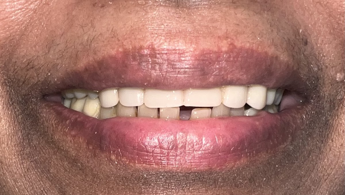 Elegant Dental Implant Center photo 5