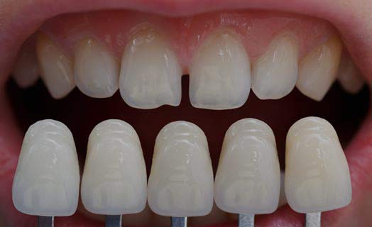 West Vancouver Dental photo 5