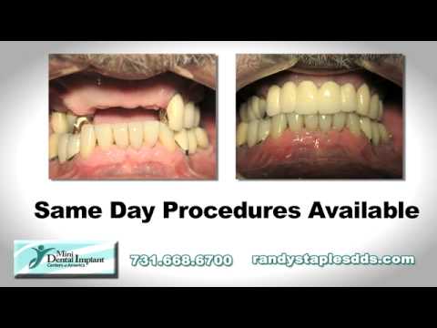 Randy Staples, DDS - Mini Implants Jackson photo 2