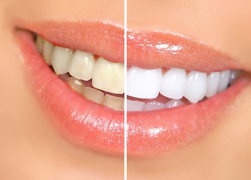 Oakhill Dental Associates photo 3