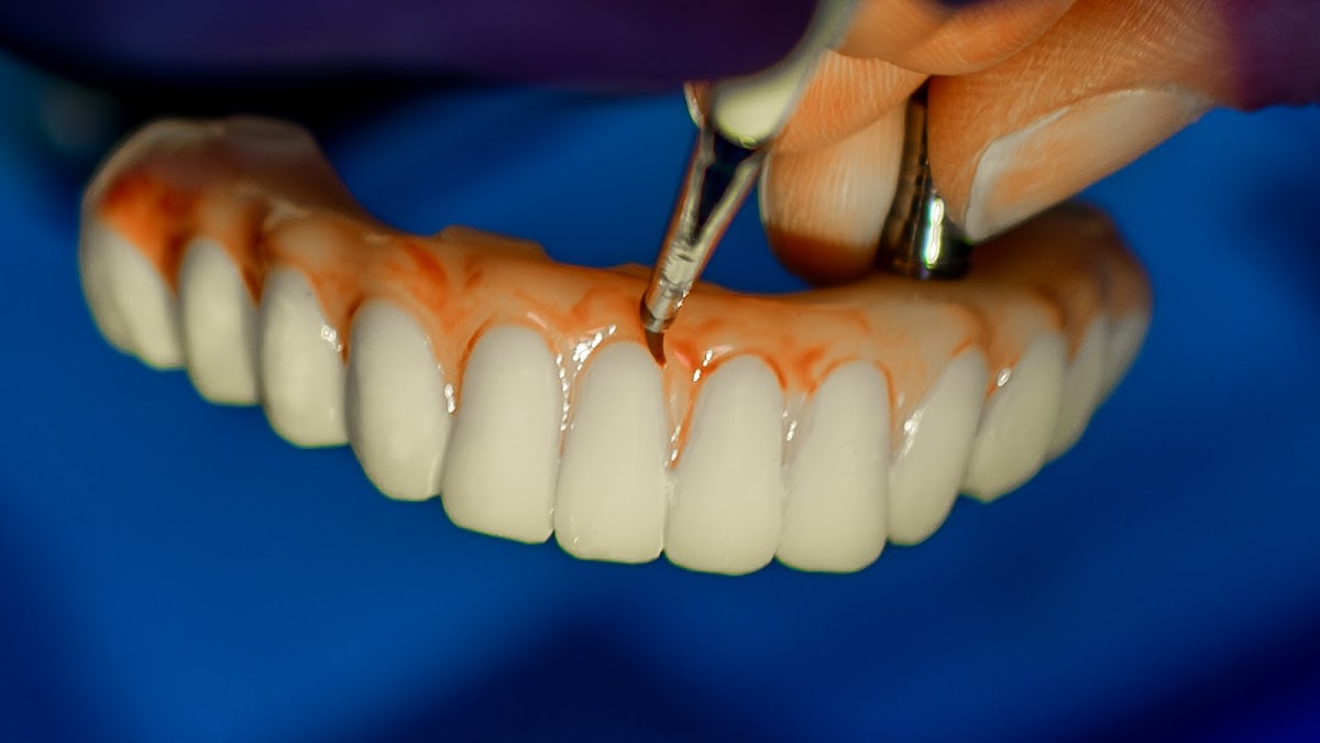Kari Mann Dental Studio: Advanced Dental Implants, Family & Cosmetic Dentistry photo 3