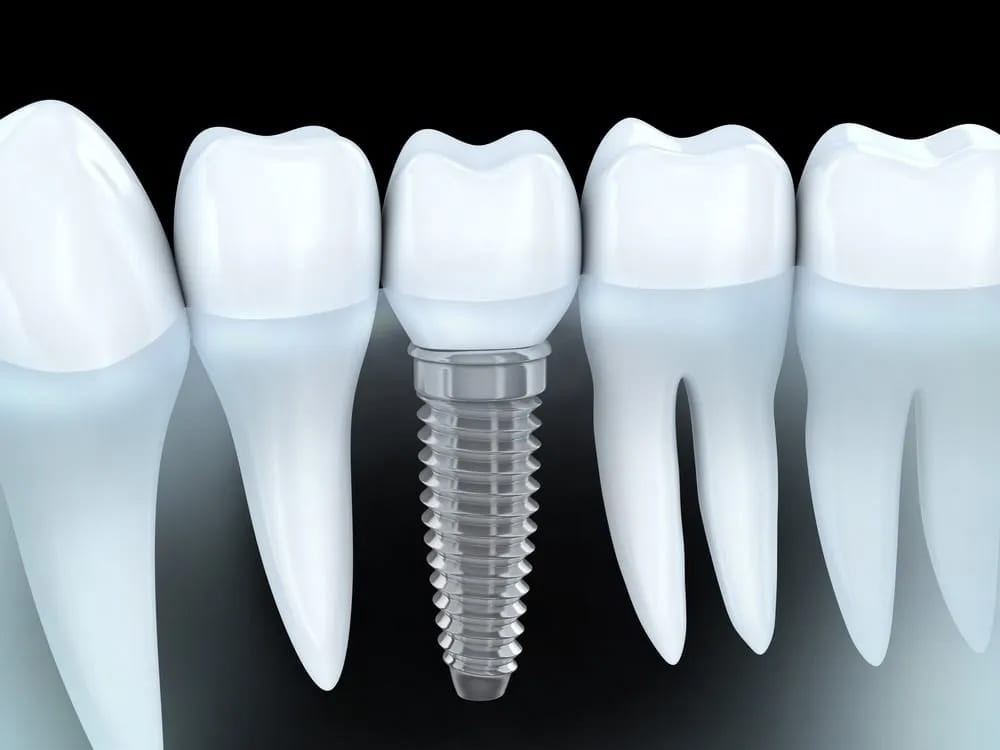 Smile Line Dentistry photo 2