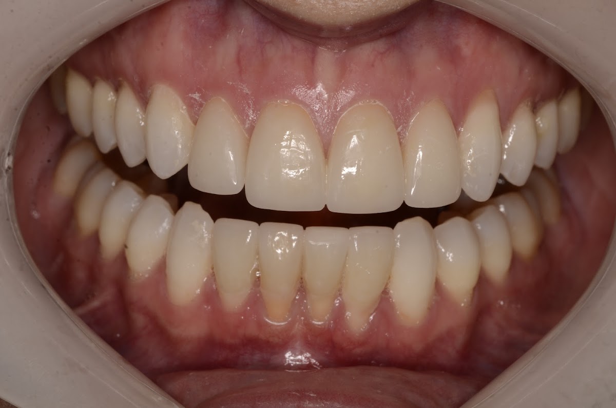 Love Dentistry - Dr. Sheri Love, DDS photo 5