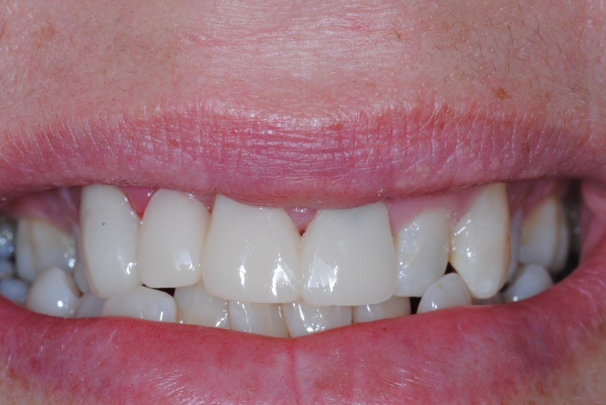 Love Dentistry - Dr. Sheri Love, DDS photo 6