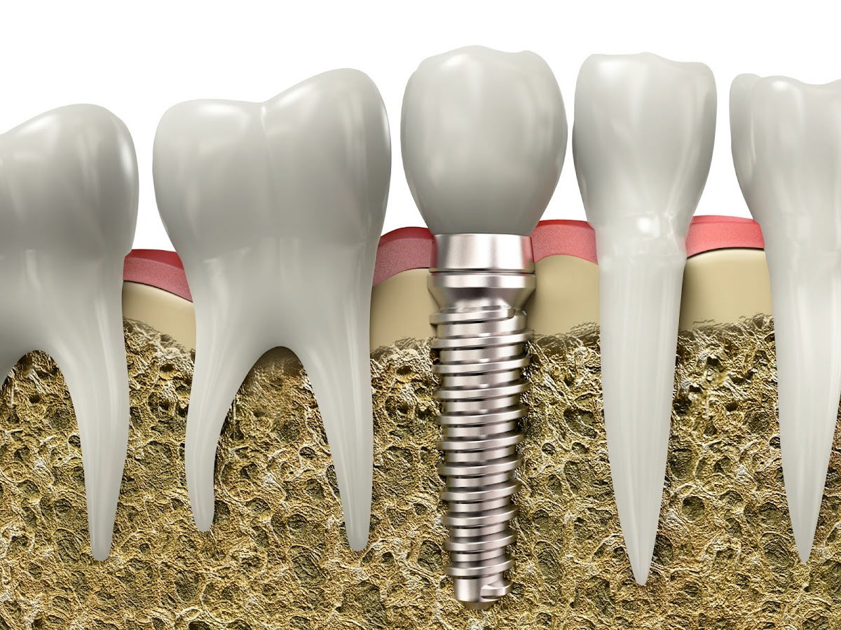 Devonshire Dental of Boston photo 5