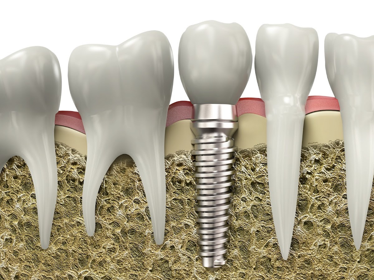 Devonshire Dental of Boston photo 5