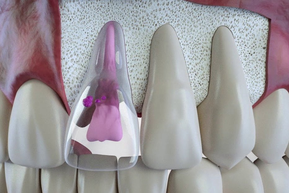 Loop Perio - Periodontics and Implants photo 6