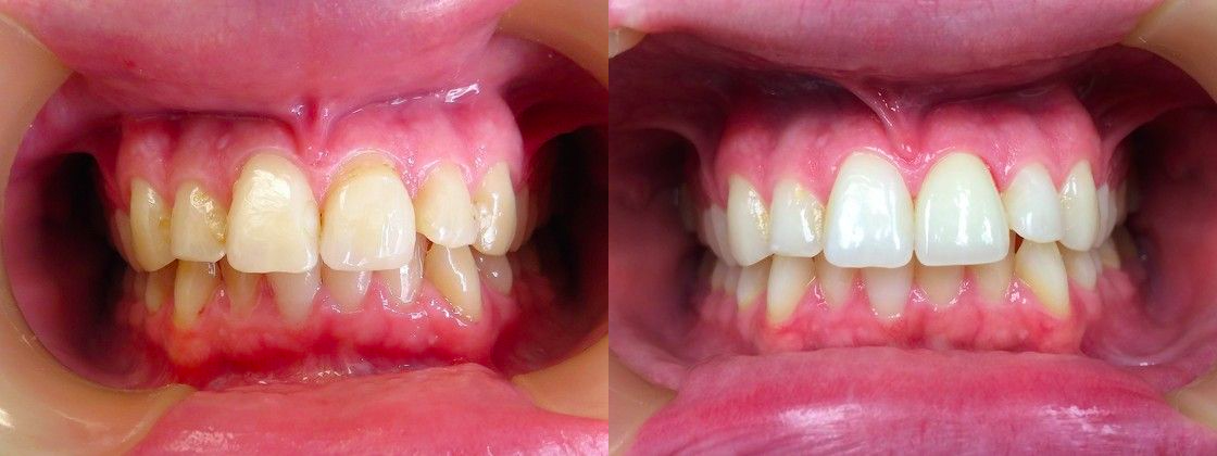 Elite Dental Care photo 3