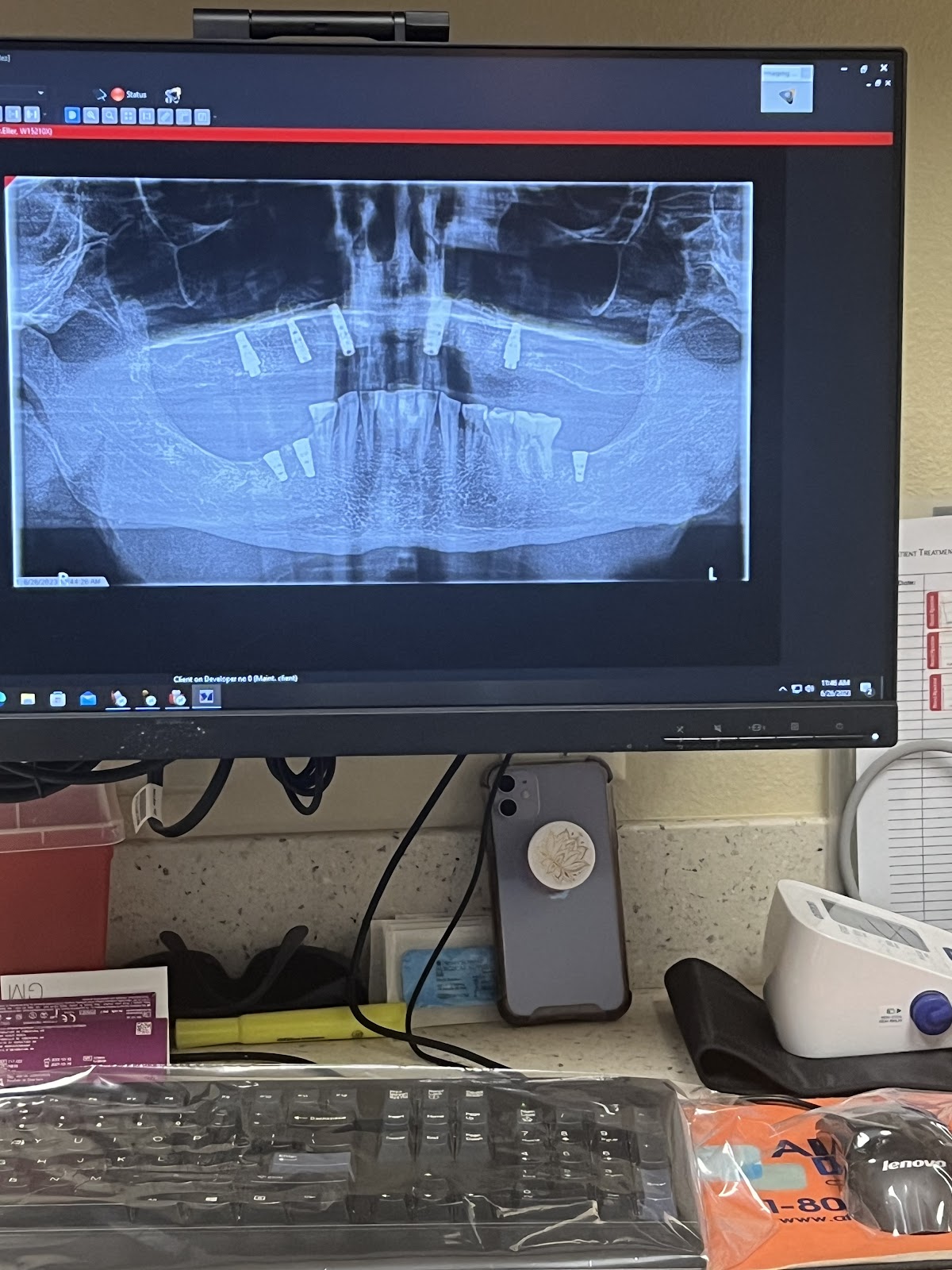 Affordable Dentures & Implants - Fort Worth photo 6