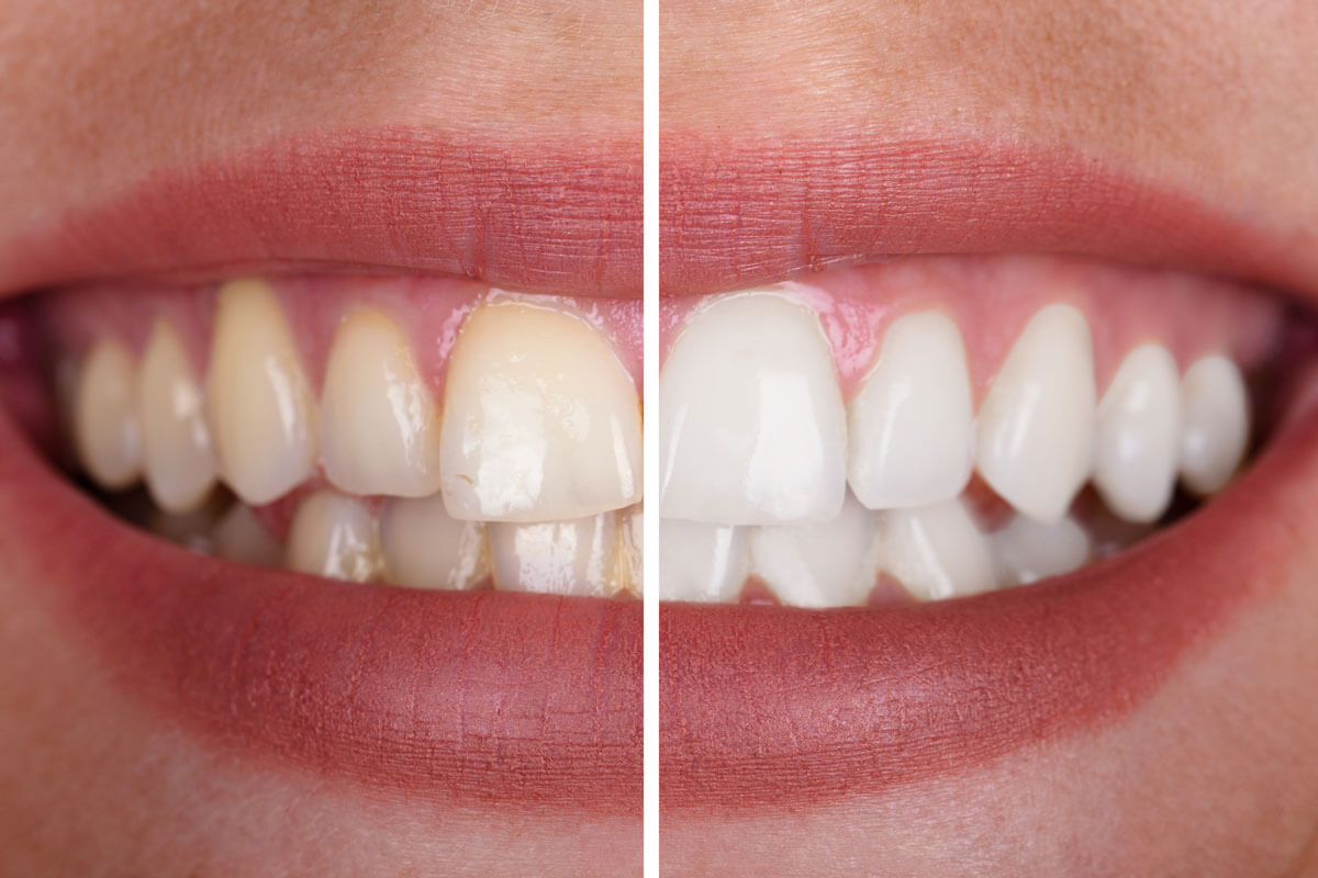 Pearl Dental Group - Jones Creek Rd. photo 4