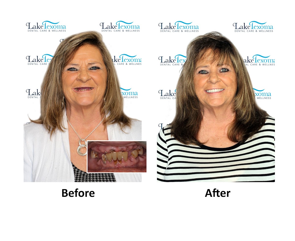 Lake Texoma Dental Care & Wellness photo 2