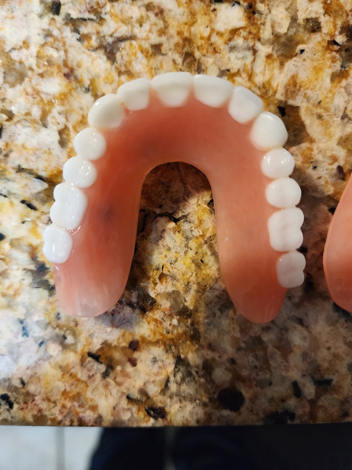 Affordable Dentures & Implants - Arlington Heights photo 2