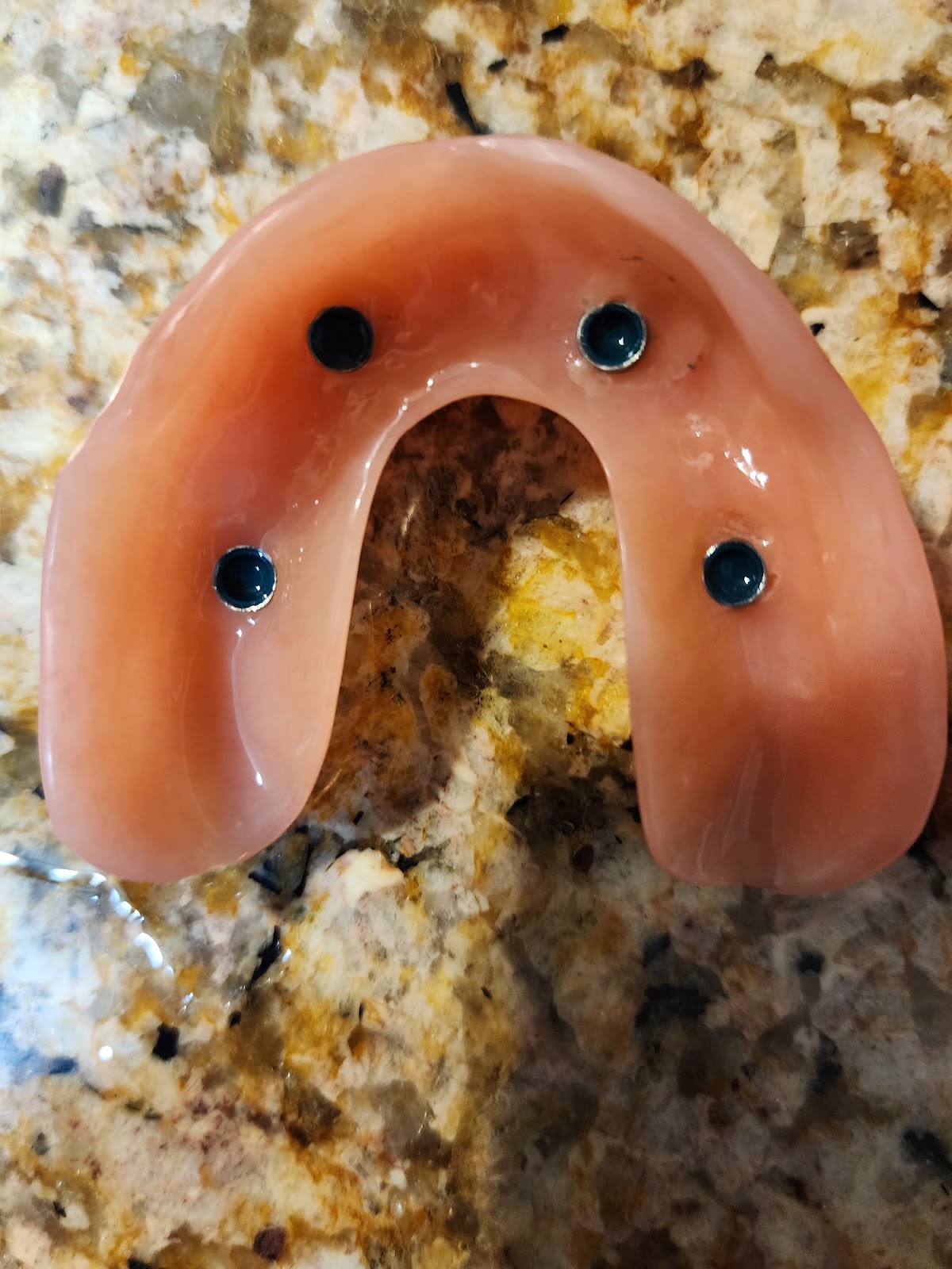 Affordable Dentures & Implants - Arlington Heights photo 4