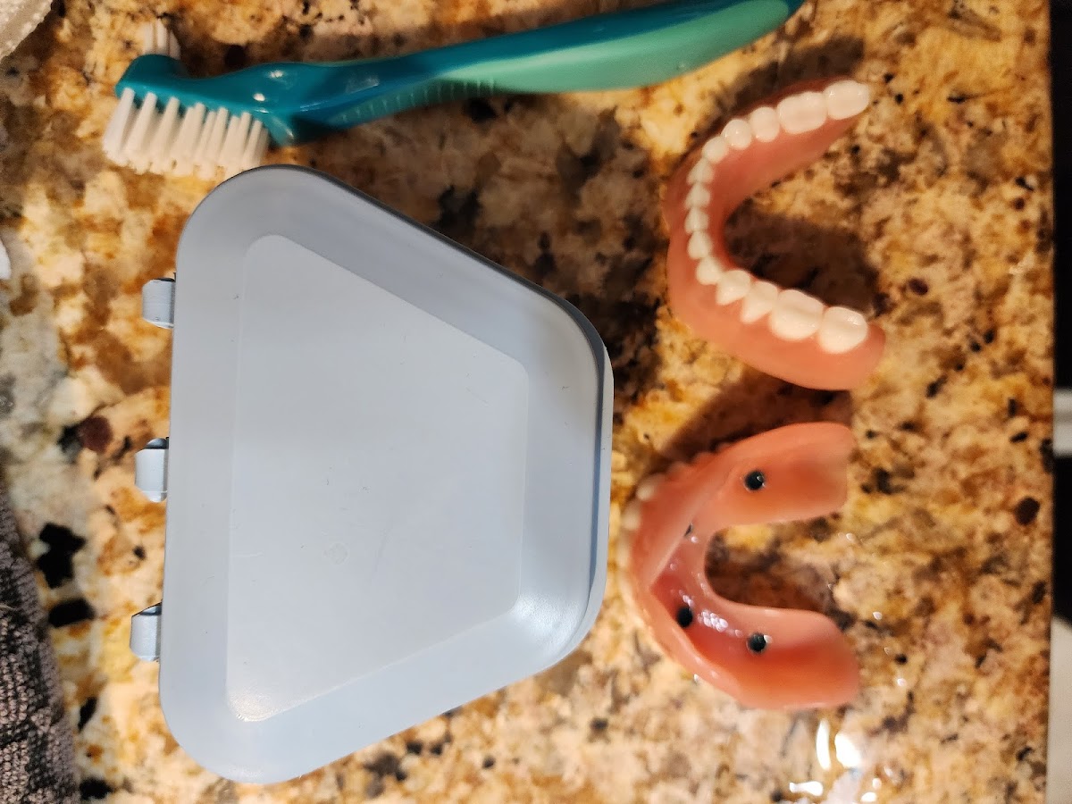 Affordable Dentures & Implants - Arlington Heights photo 5