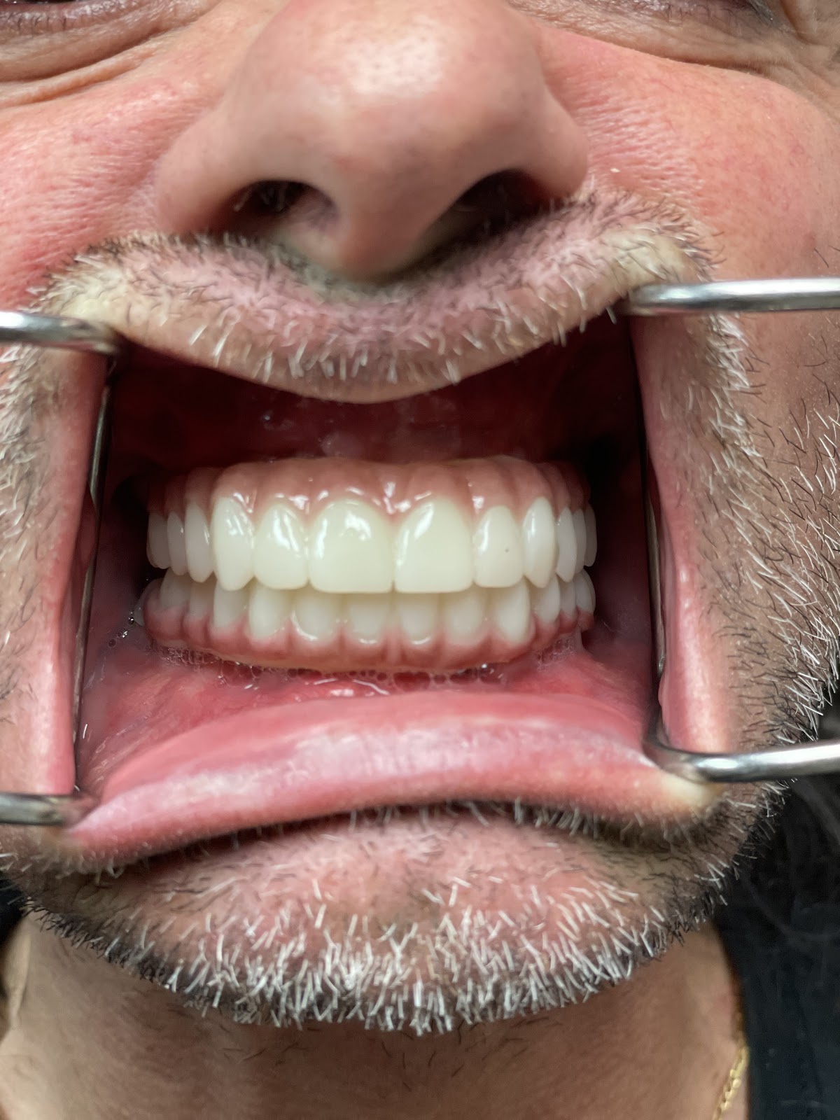 Signature Smile Dental Implant Center photo 1