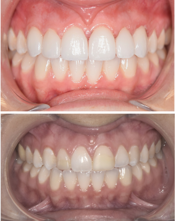 Academy of Modern Implant Dentistry - Dental Implant Center photo 6