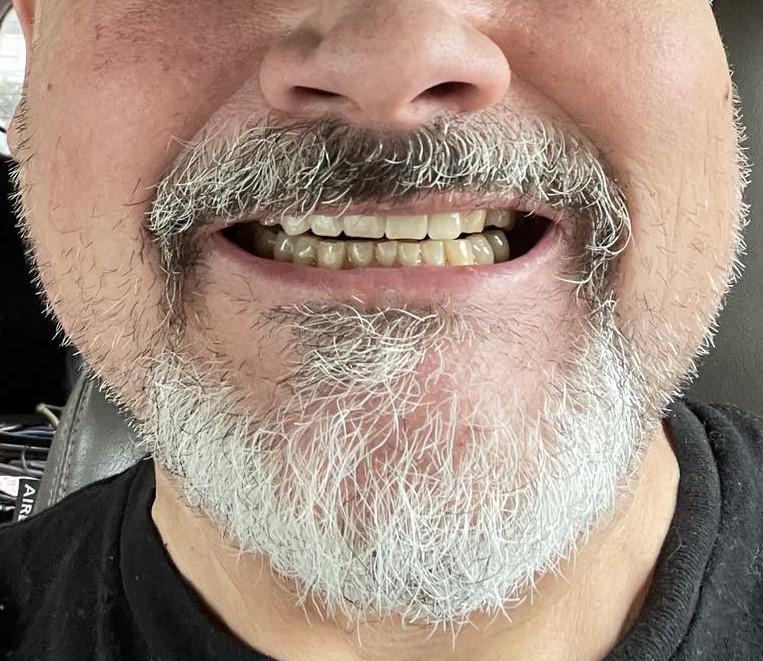 Affordable Dentures & Implants - Nashville photo 4