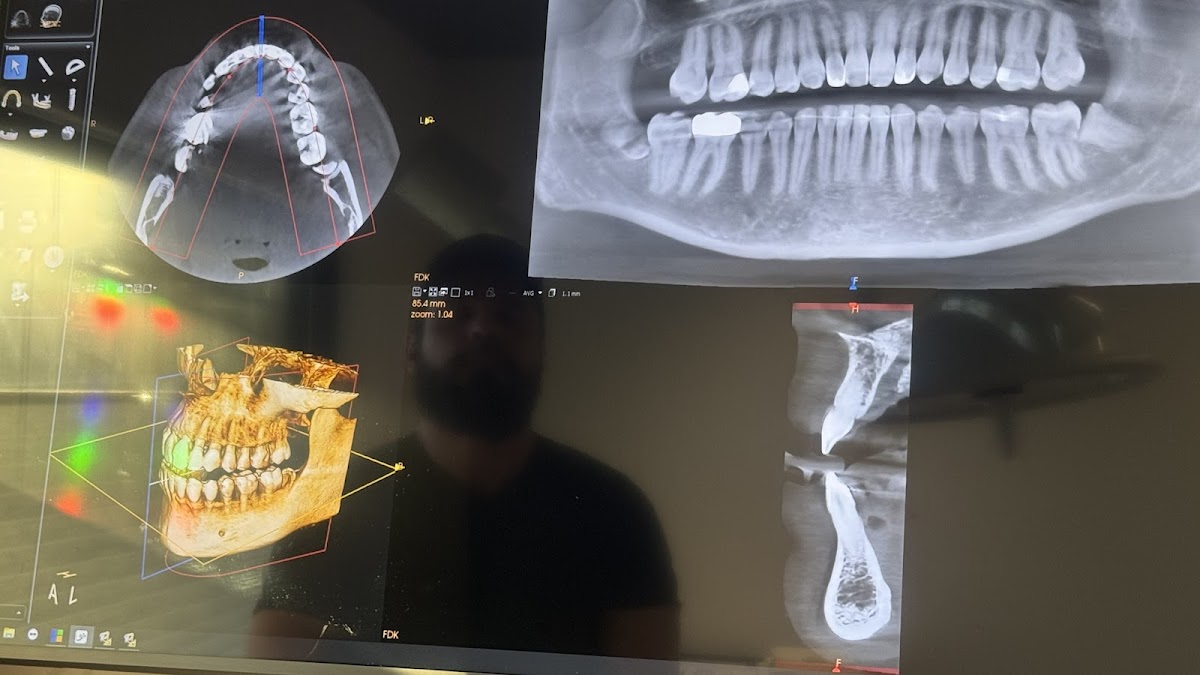 Fremont Oral & Maxillofacial Surgery photo 5