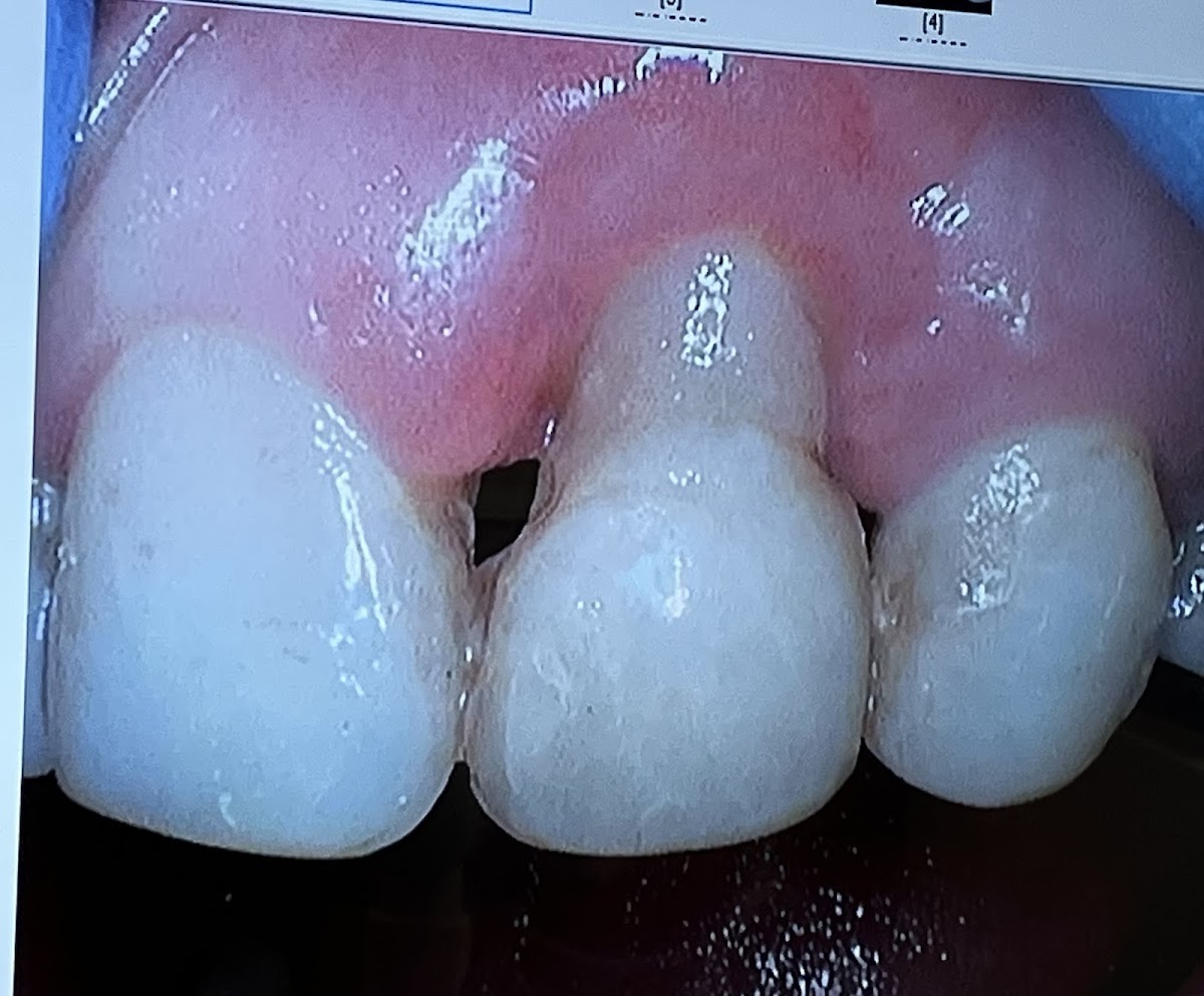 Brookline Periodontics and Oral Surgery photo 4