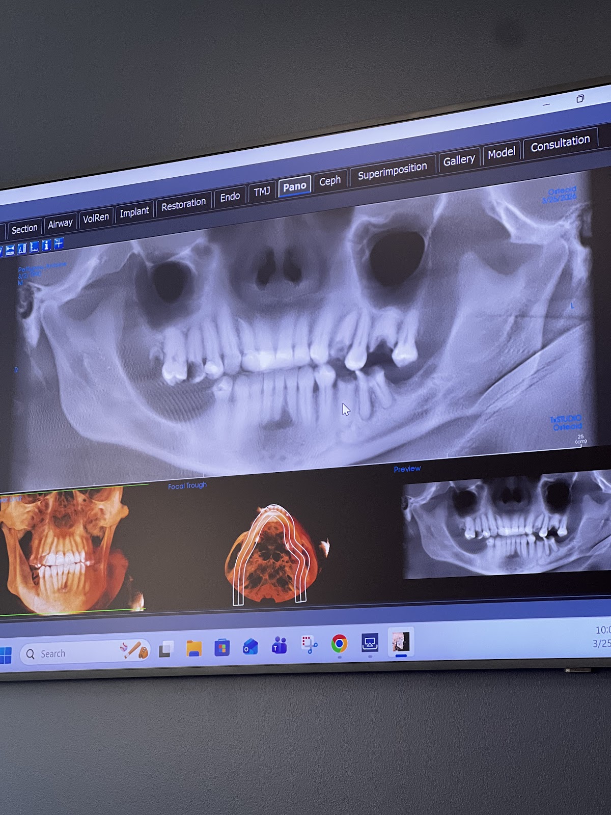Omaha & Council Bluffs Oral Surgery photo 4
