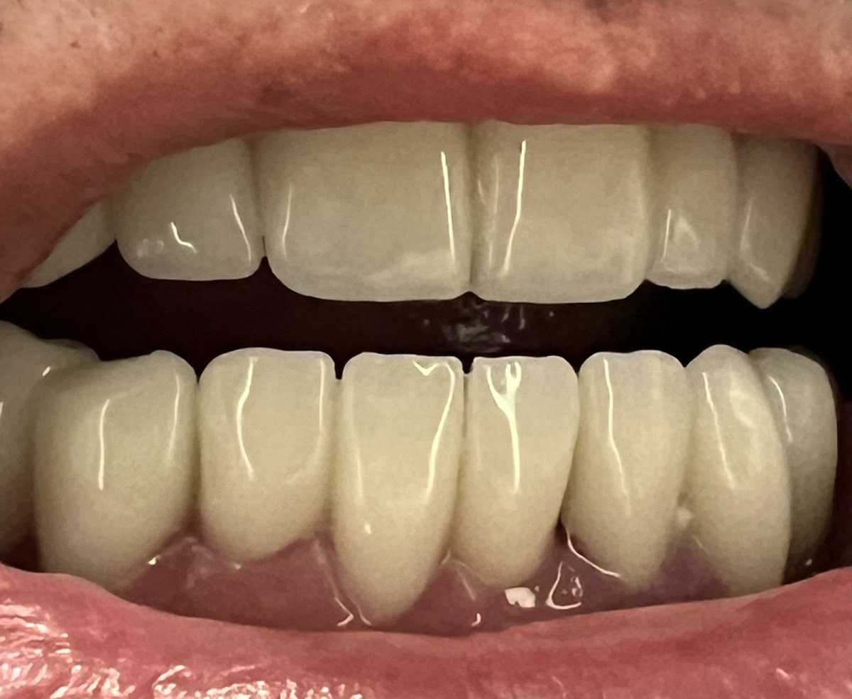 Bloomington Dental Group photo 1