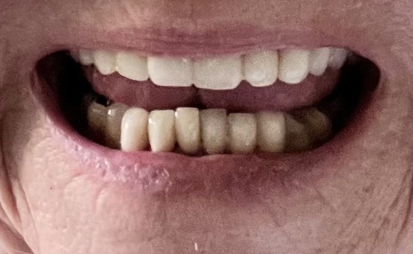 Advanced Periodontics Implant Center photo 1