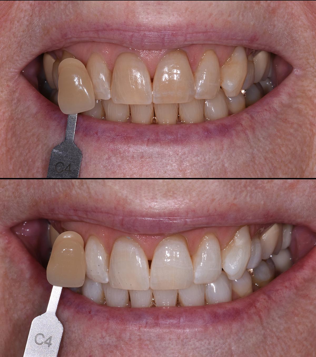 Spring Creek Dental PLLC photo 3