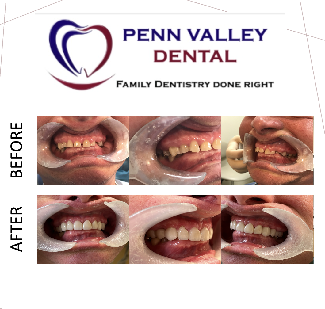 Penn Valley Dental photo 4