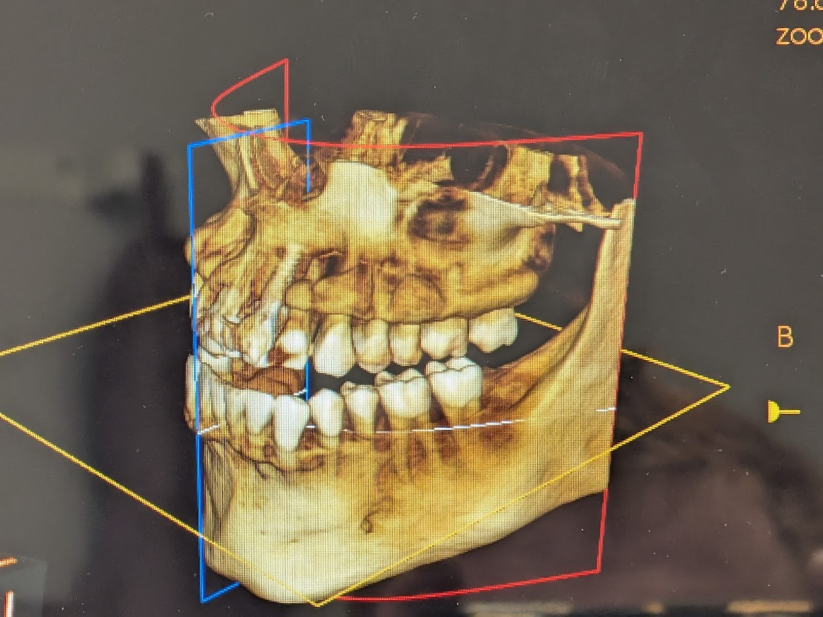 Ar Periodontal & Implant Associates - Fort Smith photo 2