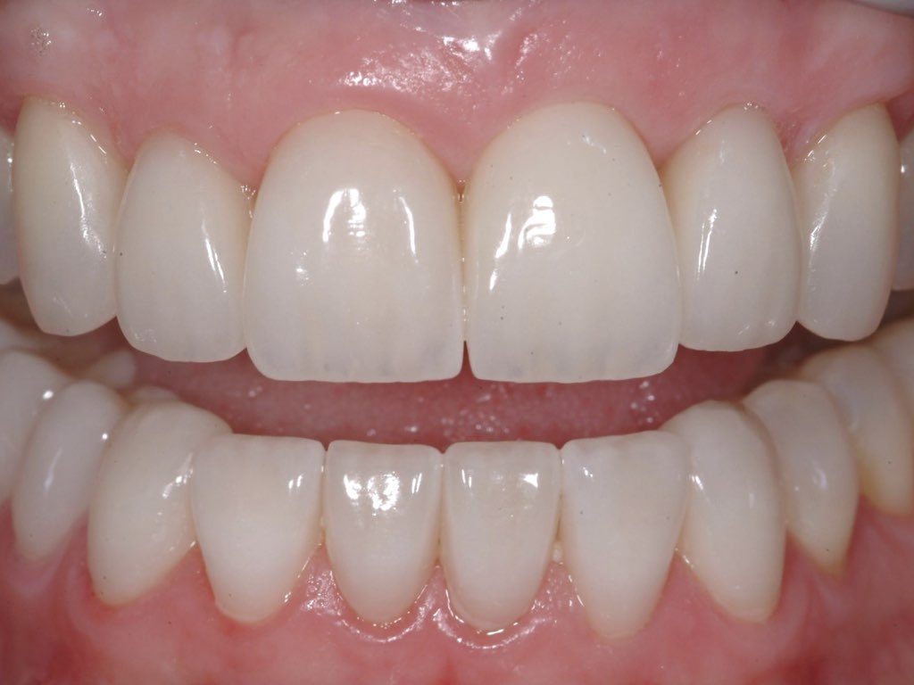 Blue Mountain Dental Care photo 3