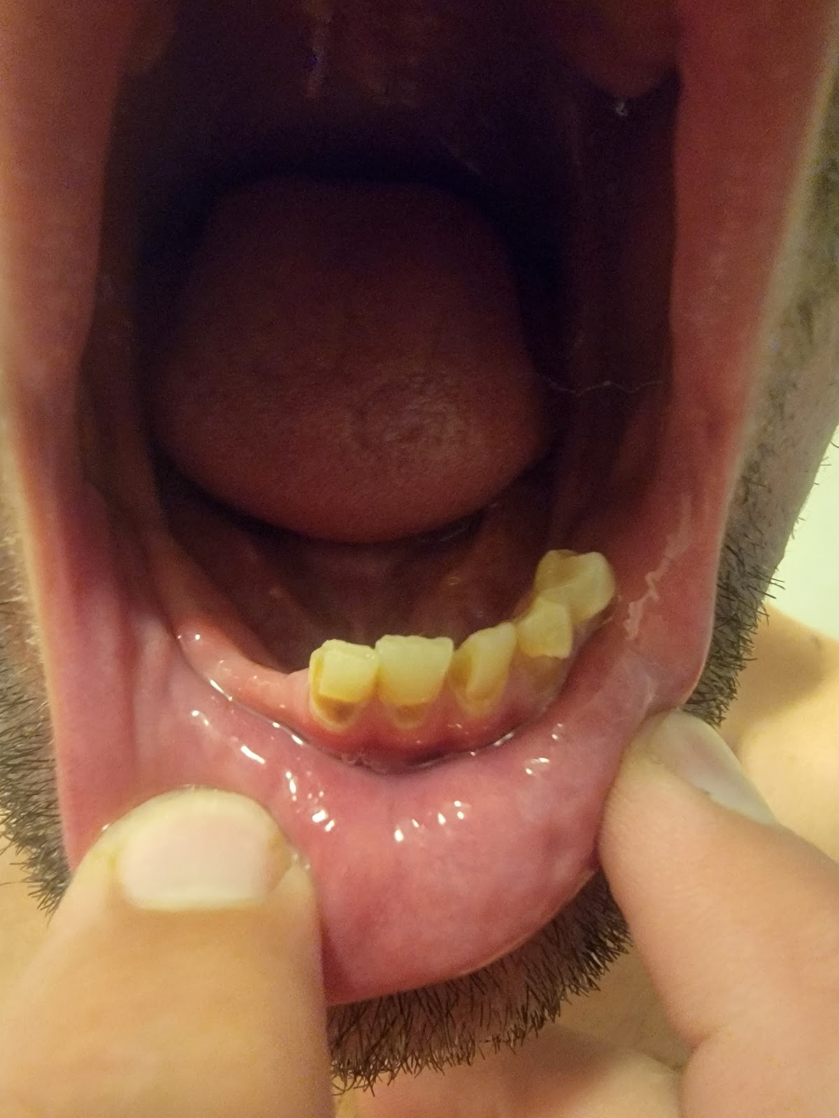 St. Petersburg Dental Implant Center photo 5