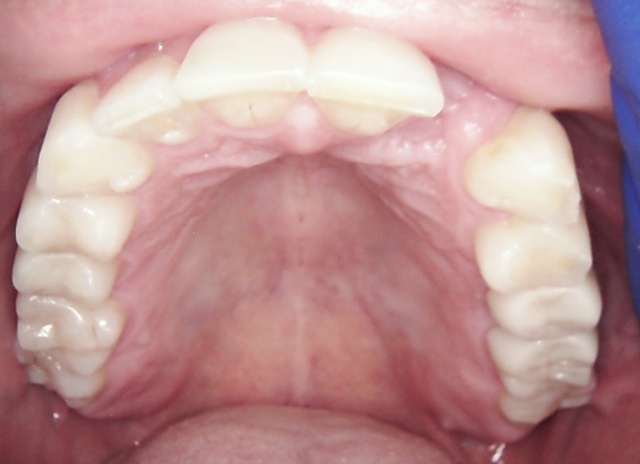 Aspen Dental - Palm Harbor photo 3