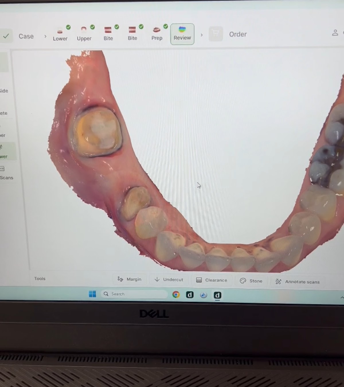 American Dental Center Of Palmdale photo 5