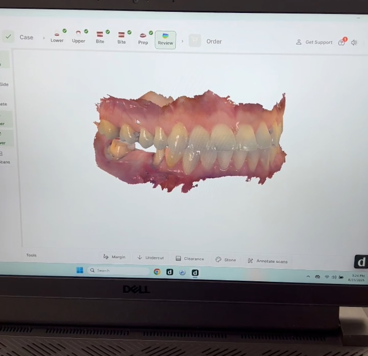 American Dental Center Of Palmdale photo 6