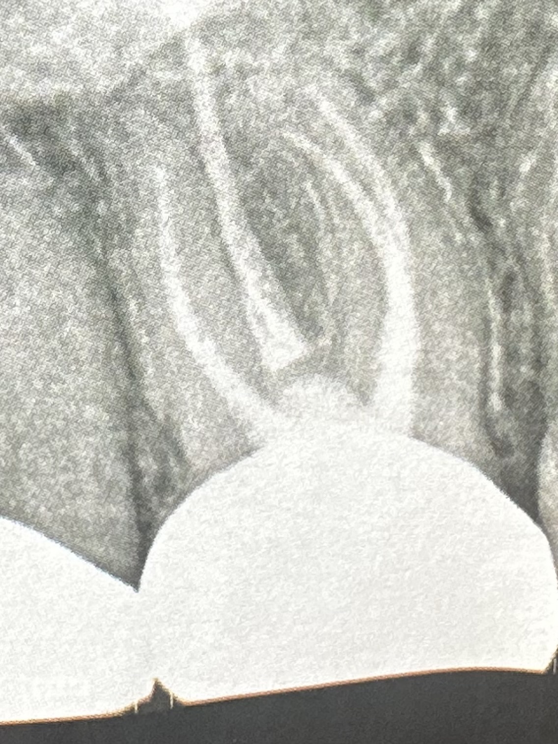 Aspen Dental - Lavale photo 5