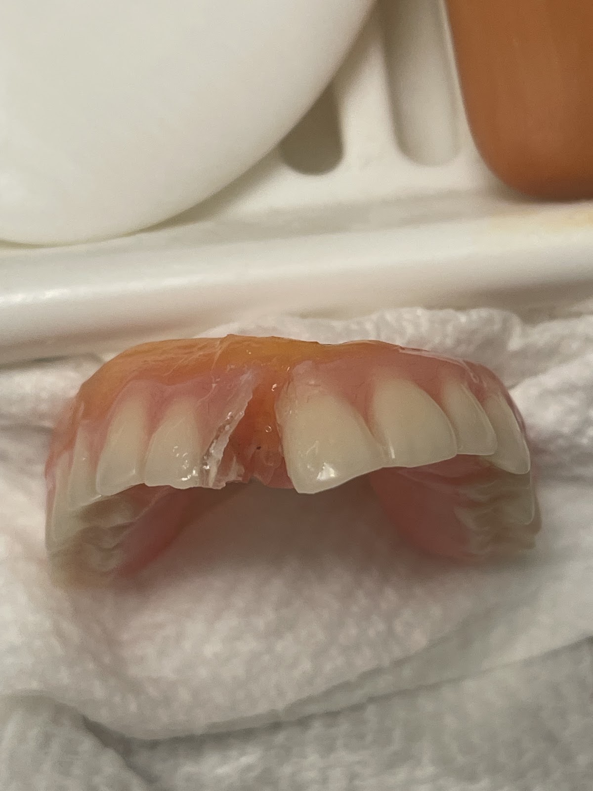 Aspen Dental - Wentzville photo 6