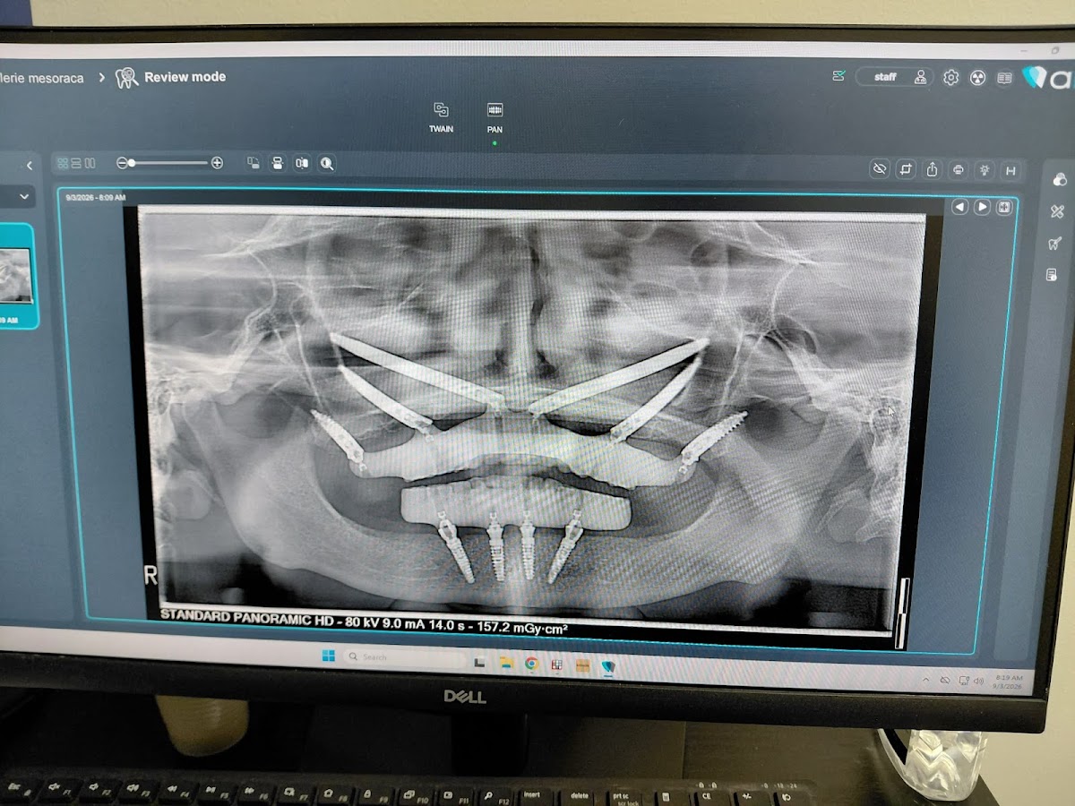 South Jersey Dentures and Implants photo 2