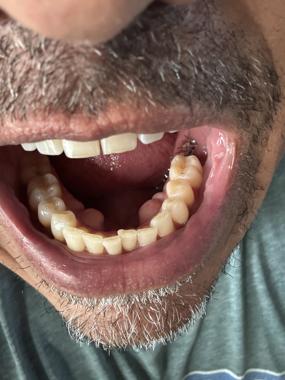 Oral Surgery of the Rockies photo 2