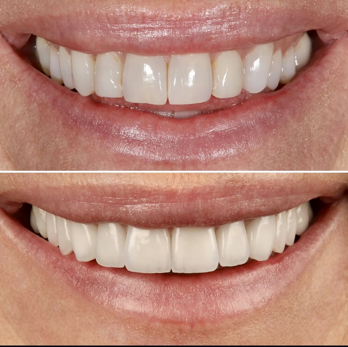 Smileology Crestview - Implant, Cosmetic & Family Dentistry photo 6