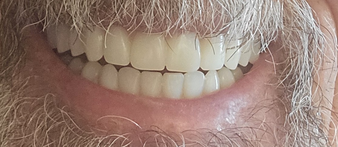 Clearchoice Dental Implant Center - South Jordan photo 6