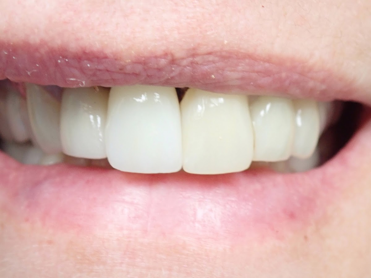Riverside Dental Ceramics photo 5