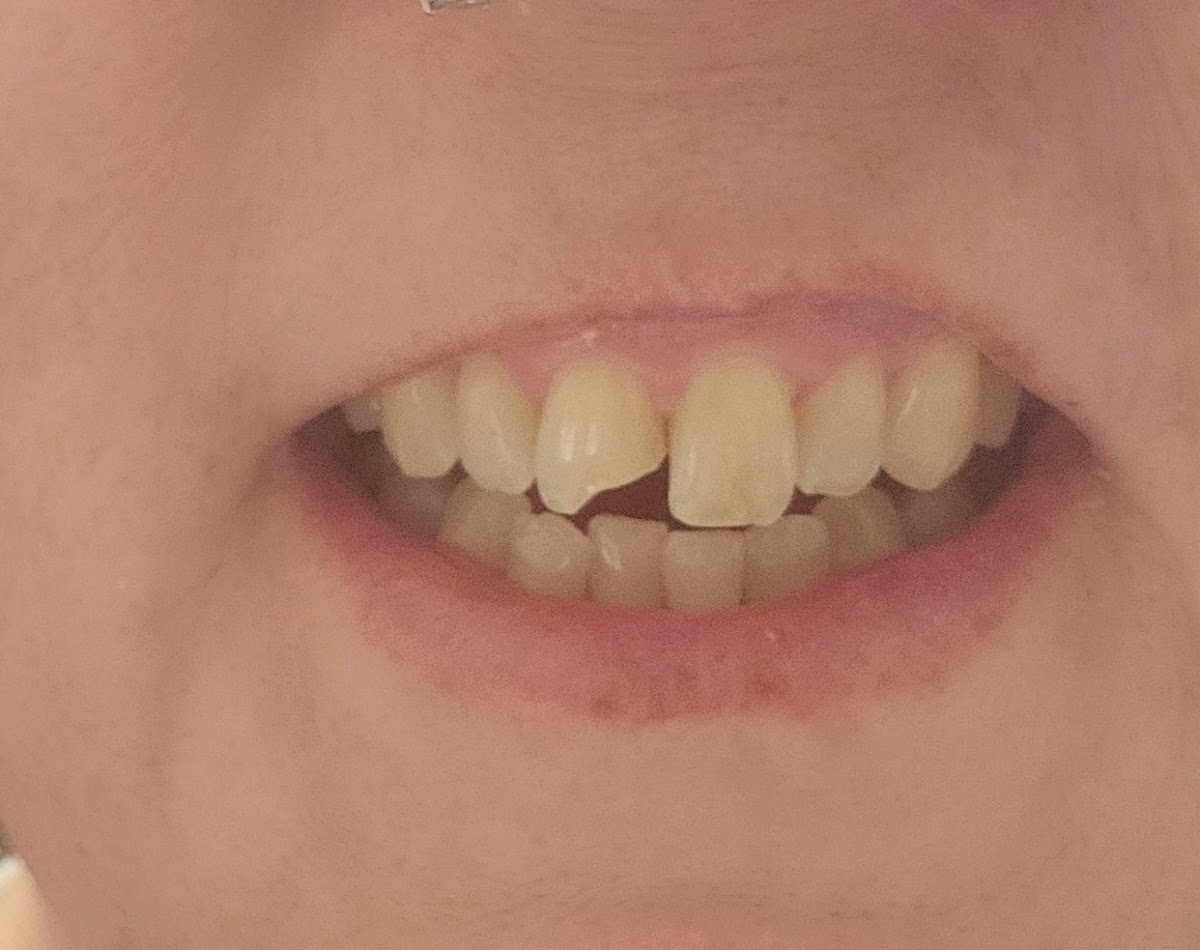 Emergency Dental Care Usa photo 3