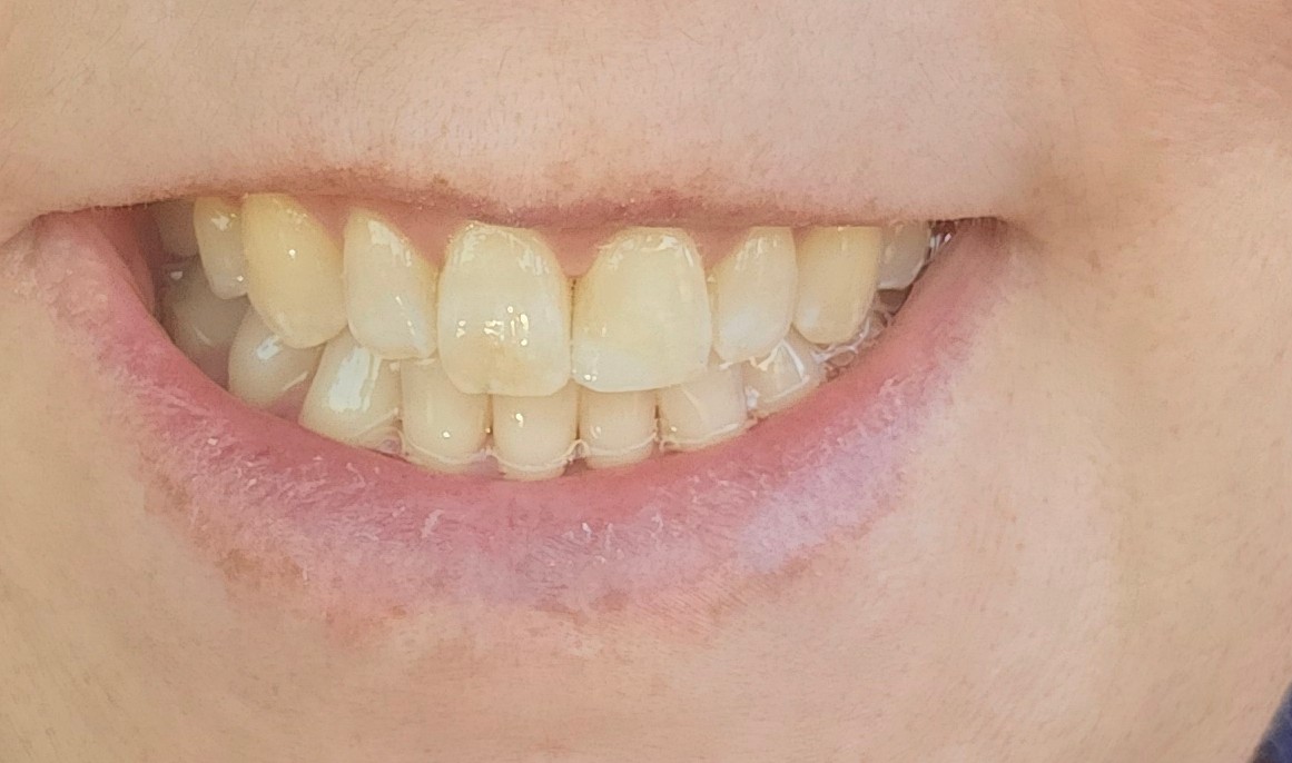 Emergency Dental Care Usa photo 5