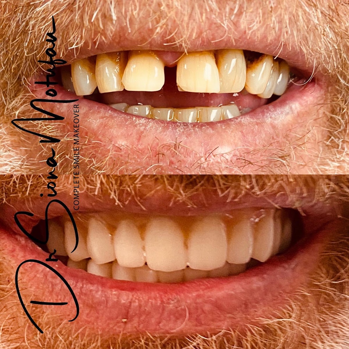 Ohana Dental Implant Centers photo 2